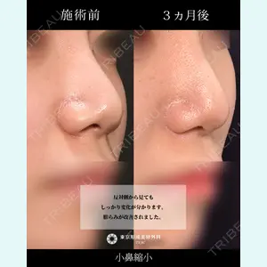 東京形成美容外科 船橋院 弓削田　浩主医師の症例