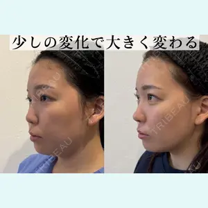 症例