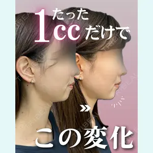 症例
