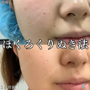 症例