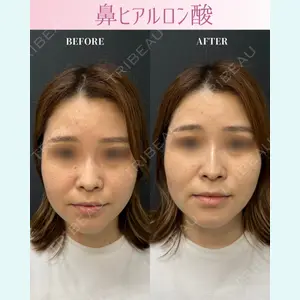 症例