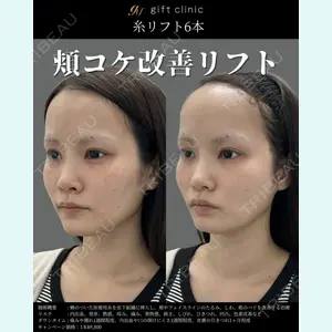 gift clinic 能登谷 翔医師の症例