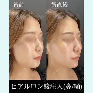 HAAB×DREAM BEAUTY CLINIC 大阪梅田院 柏木 太雅医師の症例