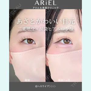 アリエル美容クリニック 郡山院 安齋 誠基医師の症例