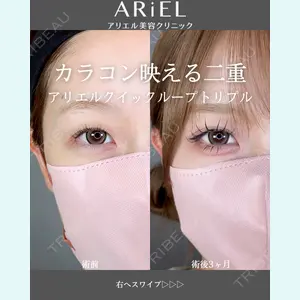 アリエル美容クリニック 郡山院 安齋 誠基医師の症例