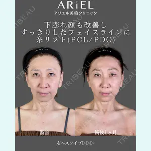 アリエル美容クリニック 郡山院 安齋 誠基医師の症例