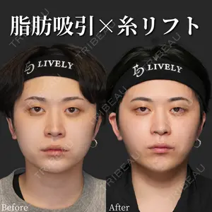 ライブリークリニック 船橋院 坂田 将彰医師の症例
