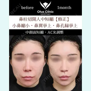 Otus Clinic 【オータスクリニック】 中 徳太郎医師の症例