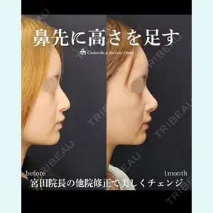 シンデレラ＆ダヴィンチクリニック 宮田 洋佑医師の症例
