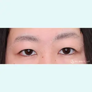 聖心美容クリニック 横浜院 佐々木 直美医師の症例