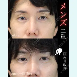 ルラ美容クリニック 池袋院 日名地 あゆみ医師の症例
