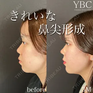 YBC横浜美容外科 立川院 大島 諒士医師の症例