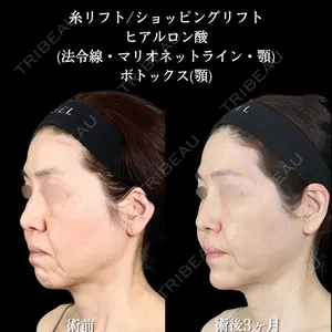アリエル美容クリニック 横浜院 渡邉 光医師の症例