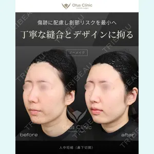 症例