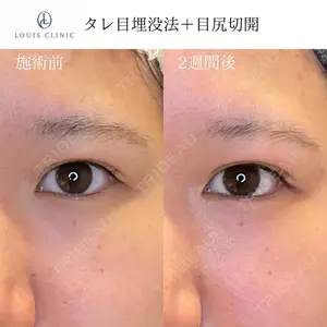 LOUIS CLINIC 二子玉川院【ルイクリニック】 小松 塁医師の症例