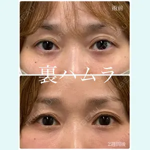 春山記念病院 山田 浩之医師の症例