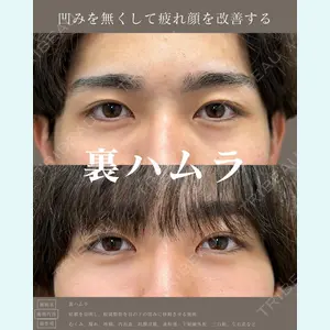 症例