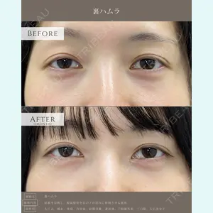 症例