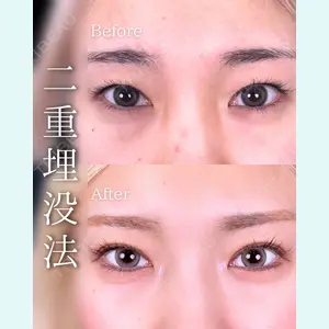 東京シンデレラ美容外科 池袋院 石井 達也医師の症例