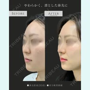 症例