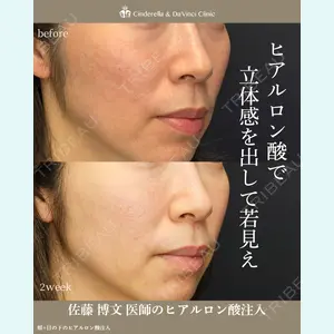 シンデレラ＆ダヴィンチクリニック 佐藤 博文医師の症例