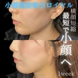 症例
