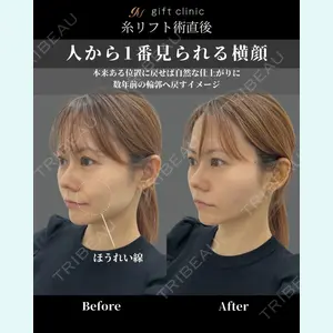 gift clinic 能登谷 翔医師の症例