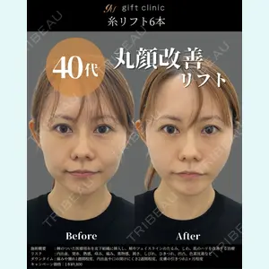 gift clinic 能登谷 翔医師の症例