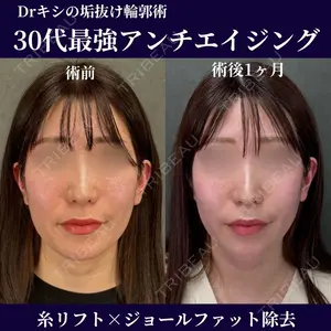 ネビュラクリニック 京都院 岸 大輔医師の症例
