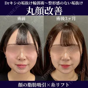 ネビュラクリニック 京都院 岸 大輔医師の症例