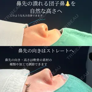 ネビュラクリニック 京都院 岸 大輔医師の症例