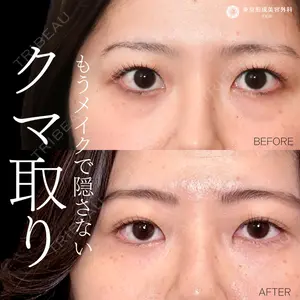 症例