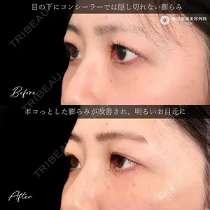 東京形成美容外科 船橋院 山崎 修吾医師の症例