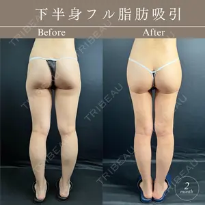 症例
