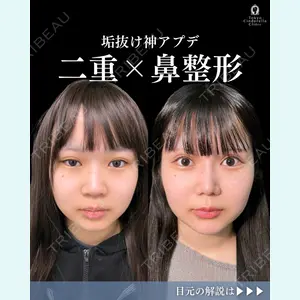症例