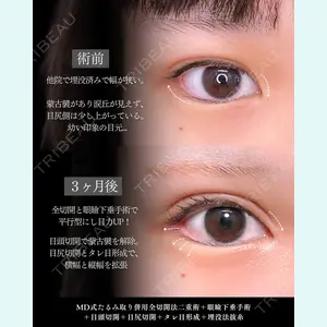 症例
