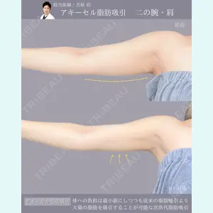 症例