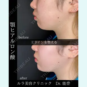 ルラ美容クリニック 札幌院 能登 貴弘医師の症例