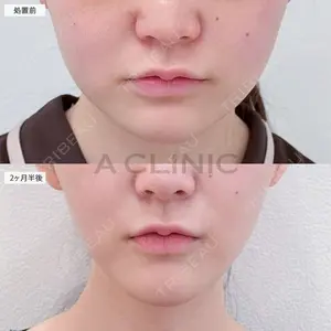 A CLINIC（エークリニック） 大阪院 田窪 賢志郎医師の症例