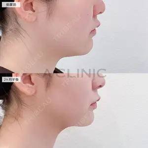 A CLINIC（エークリニック） 大阪院 田窪 賢志郎医師の症例