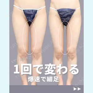 症例