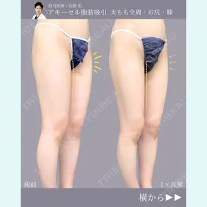 症例