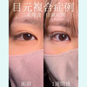 症例