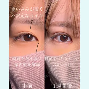 症例