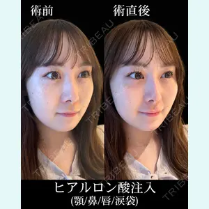 HAAB×DREAM BEAUTY CLINIC 東京本院 佐野 圭医師の症例