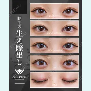 症例