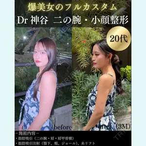 症例