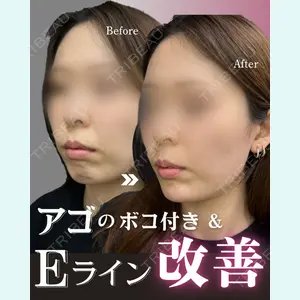 症例