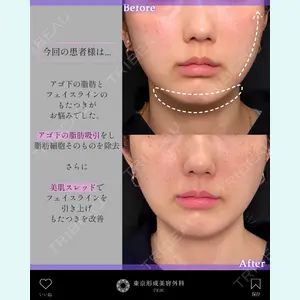 東京形成美容外科 銀座院 中尾 真紀医師の症例