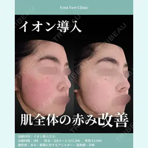 ヴァンヴェールクリニック 高槻院の症例